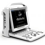 Chison-ECO-3Vet-Veterinary-Ultrasound-Machine-With-One-Probe-at-Choice-0