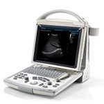 Keebdray-DP20Vet-Veterinary-SMAll-animal-Ultrasound-with-Micro-convex-probe-0-0